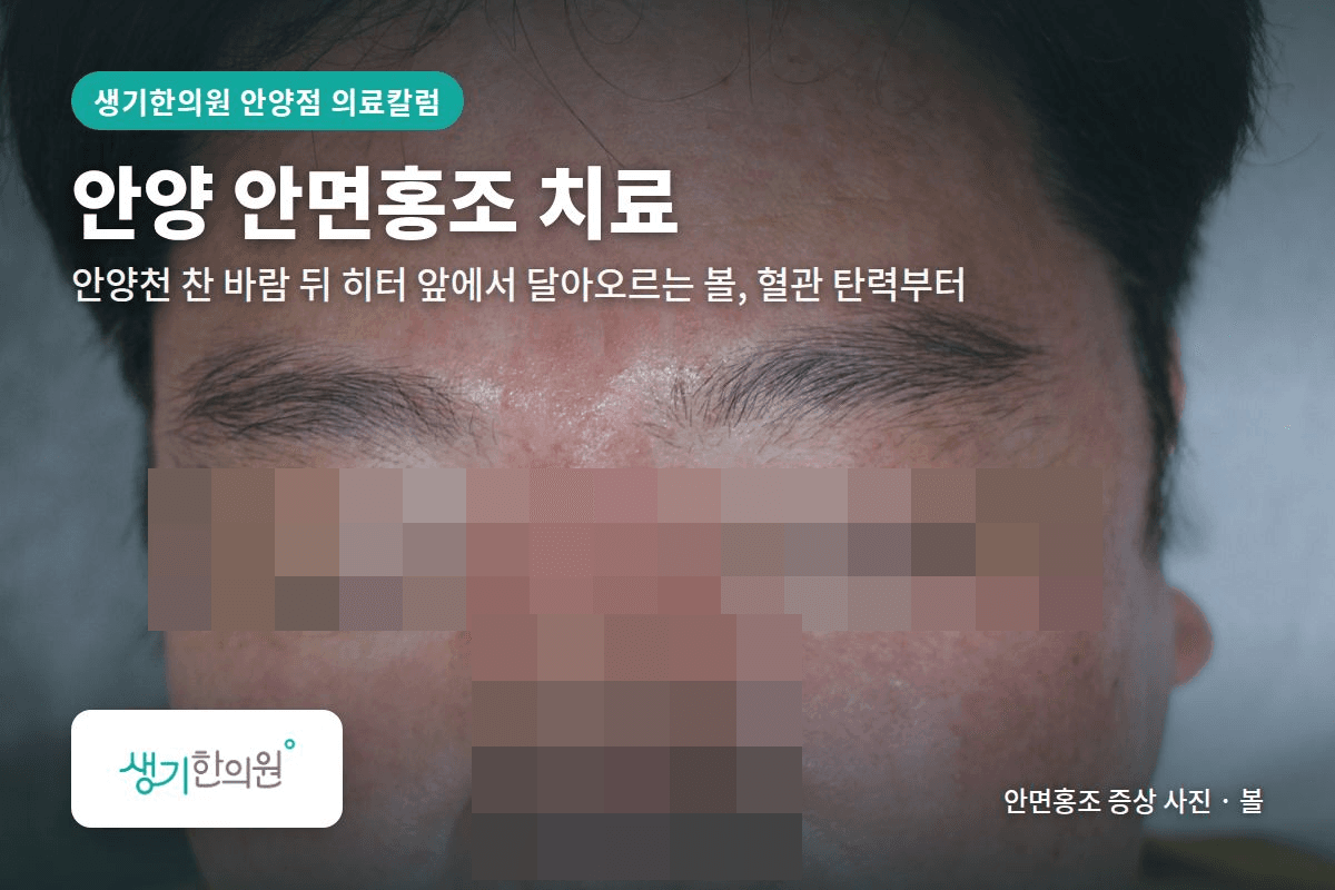 볼 안면홍조 증상 사진과 문구 「안양 안면홍조 치료, 안양천 찬 바람 뒤 히터 앞에서 달아오르는 볼, 혈관 탄력부터 · 생기한의원 안양점」