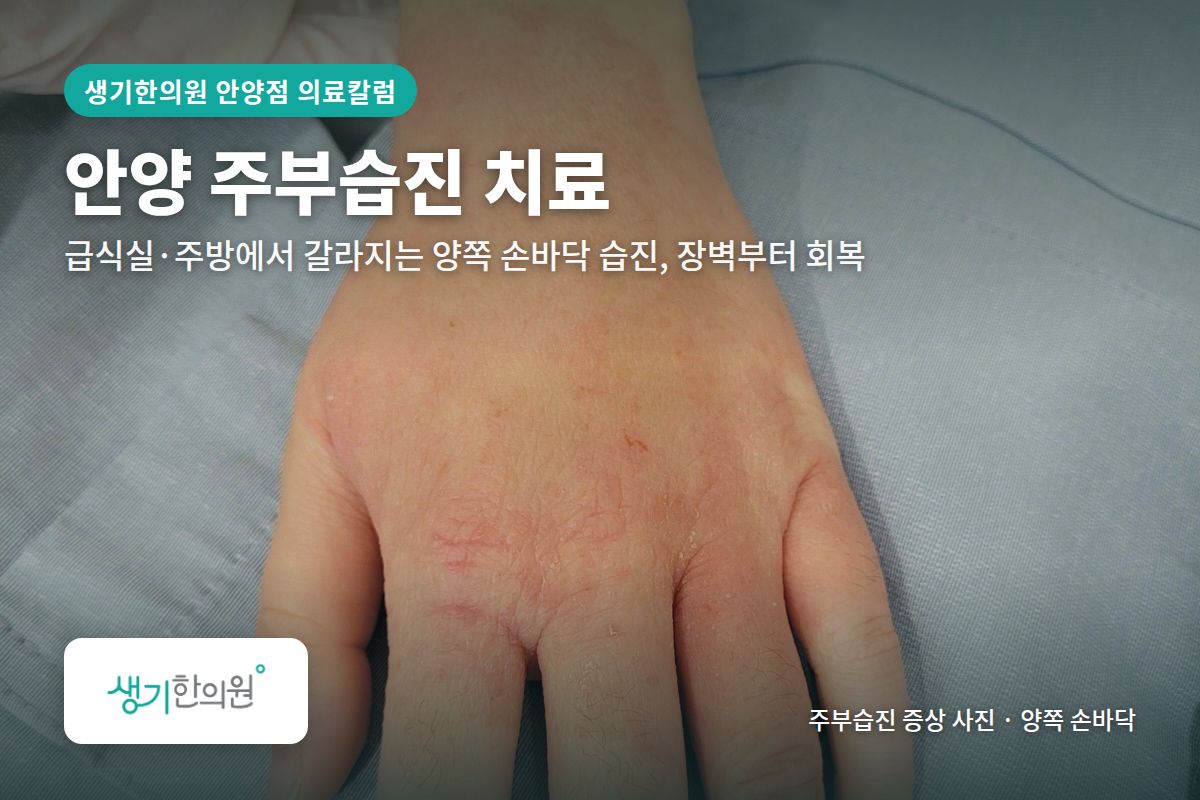 양쪽 손바닥 주부습진 증상 사진과 문구 「안양 주부습진 치료, 급식실·주방에서 갈라지는 양쪽 손바닥 습진, 장벽부터 회복 · 생기한의원 안양점」